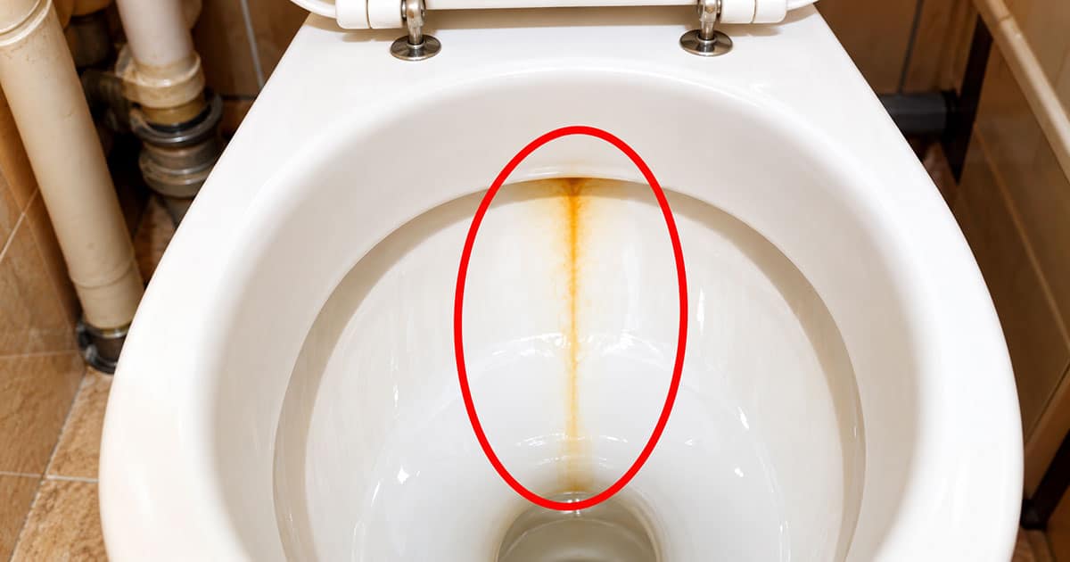 Vakare uždedu ant geltonų unitazo apnašų, ryte belieka nušveisti